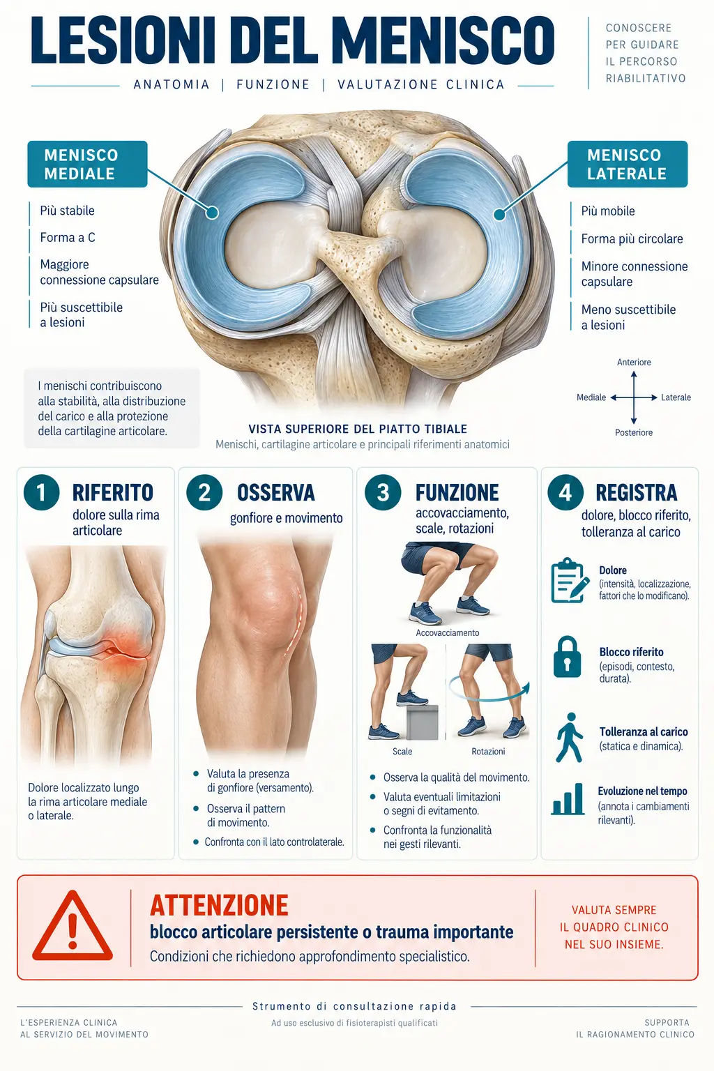 Lesioni del menisco